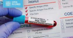 test-psa-proste-badanie-wielkie-znaczenie-co-powinienes-wiedziec-o-kluczowym-badaniu-w-diagnostyce-schorzen-prostaty.webp