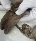 псдц анат.театр.webm