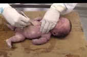 baby autopsy.webm