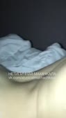 15529179289650.mp4