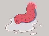 prolapse1.png