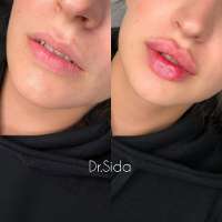 lips.jpg