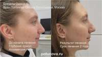 IMG7406.webp