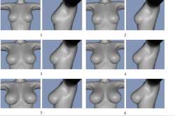 breast.PNG