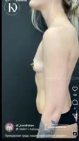 VID20250715104150841.mp4