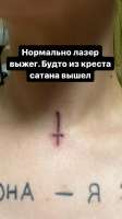 тату лазер photo2023-08-0900-01-18 .jpg
