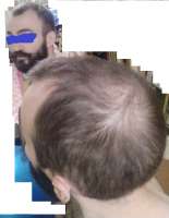 IMG20200821004540лысина.jpg