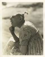 Schlitzie-man-with-microcephaly-1-1[1].jpg