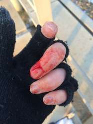 Rina29BloodyFingers.png