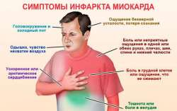 osnovnye-simptomy-infarkta-miokardas.jpg