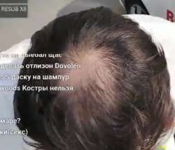 лысое хуйло.png