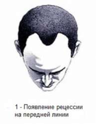 032627703.png