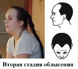 яна лысая янный   .jpg
