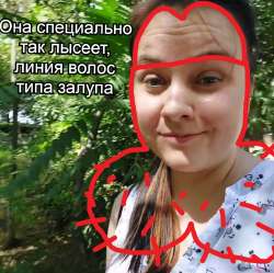 залупка.jpg