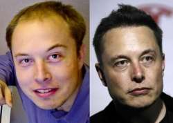 elon-musk-peresadka-volos.jpg