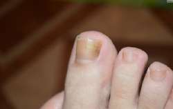 4Zmxqk0ml87AzUXoTy9UHg.jpg