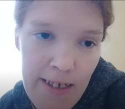 pussyprolapse.jpg