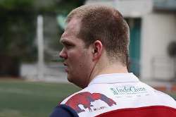Rugbyplayerwithapronouncedsupraorbitalridge.jpg