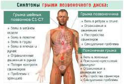 simptomy-gryzhi-pozv.jpg