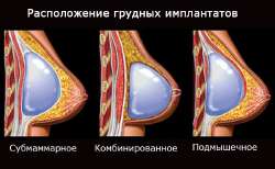 IMG20250701155450611.jpg