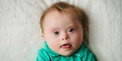 downsyndromeb2.jpg