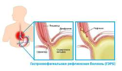 nq25u40xyao7wuc231ta2yg31o85f81z.JPG