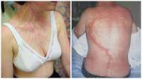 lightning-scars.jpg