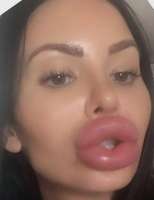 xmok.webp