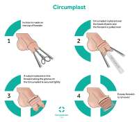 Circumplast-01-2-2048x1809-1.jpg