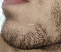 4234255.jpg