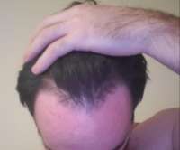 f3z69f6avlr51.jpg