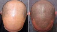 htbeforeafterhairtattoont120530wmain.jpg