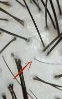 minoxidil-experiment-on-single-hair-follicle-v0-ju6esb0p6k7f1.webp
