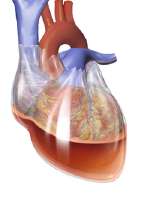 Blausen0164CardiacTamponade02.png