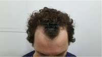 widows-peak-example.jpeg