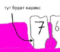 7zub+.jpg