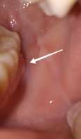 IMG20230322232135.jpg