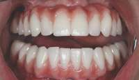 sdt-step4.jpg