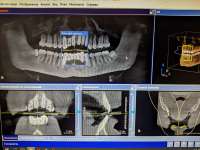 imgonline-com-ua-dexifCSslPYO94T4a.jpg
