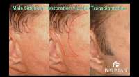 becky-plastic-surgery-hair-loss.male.sideburn.jpg