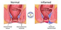 Anal-canal-diagram.webp