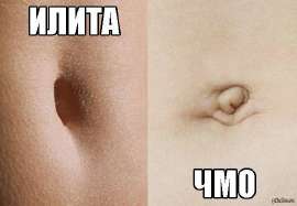 чмо-илита.jpg
