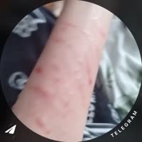 17506937059531.mp4