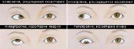 squint.jpg