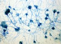 Aspergillus.jpg