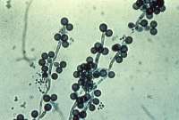 Candida2.jpg