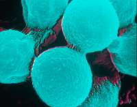 cryptococcus-neoformans-restricted.jpg