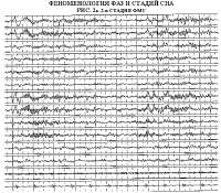 ris2a.gif