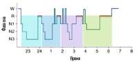 sleep-cycles-sample-500x227.png
