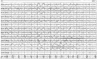 ris2.gif